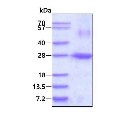 SDS-PAGE Recombinant Human ARL4 His Protein
